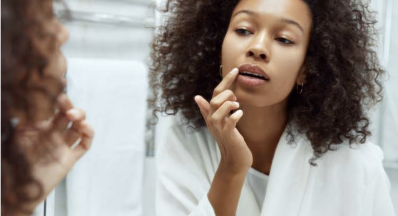 Cold Sores Study